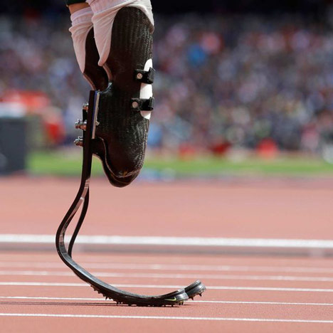 Cheetah carbon fiber prostheses: Are they right for you?